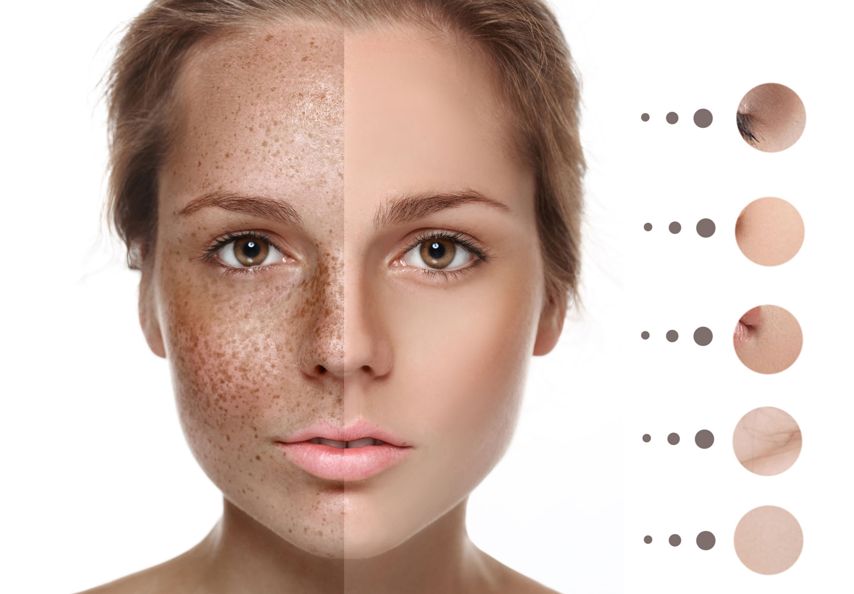 Types Of Pigmentation And What Caused This Skinmatters